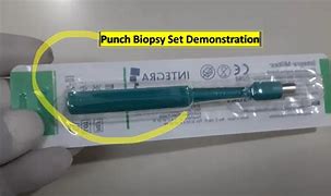 Punch Biopsi Adalah